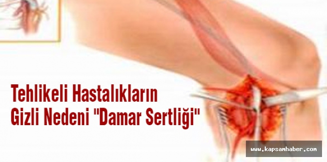 Tehlikeli Hastalıkların Gizli Nedeni "Damar Sertliği"