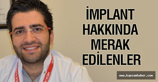 İMPLANT HAKKINDA MERAK EDİLENLER