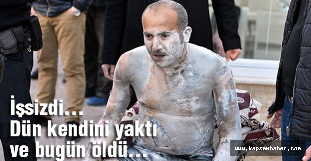 İşsizlikten kendini yakan adam öldü...