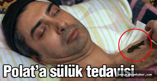 Polat'a sülük tedavisi...