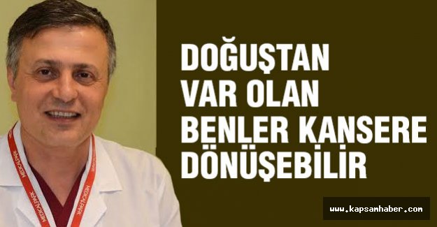 DOĞUŞTAN VAR OLAN BENLER KANSERE DÖNÜŞEBİLİR