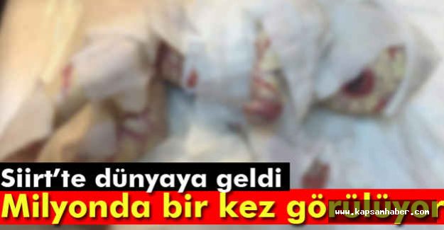 Bu Milyonda bir kez görülüyor...