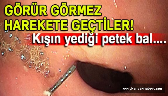 Petek bal yedi, midesinden Bakın Ne Çıktı?