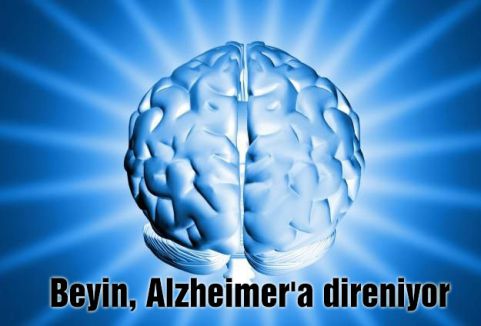 Beyin, Alzheimer'a direniyor