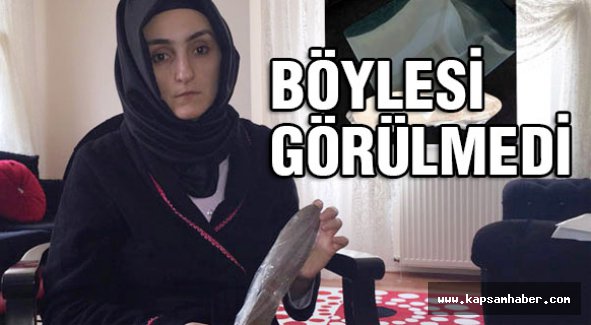Bu kadarı da fazla: Kadının karnında unutulan şeye bakın!