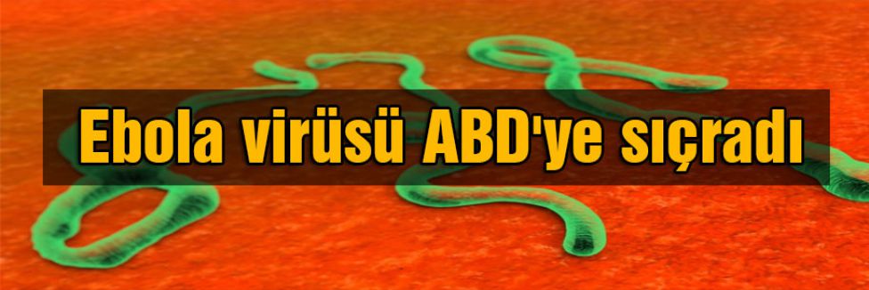 Ebola ABD'de görüldü!