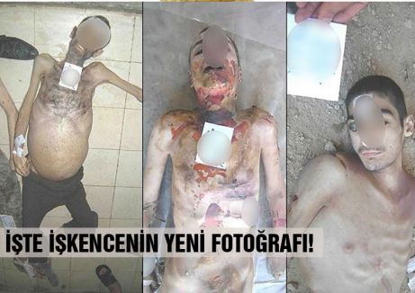 İŞTE İŞKENCENİN YENİ FOTOĞRAFI!