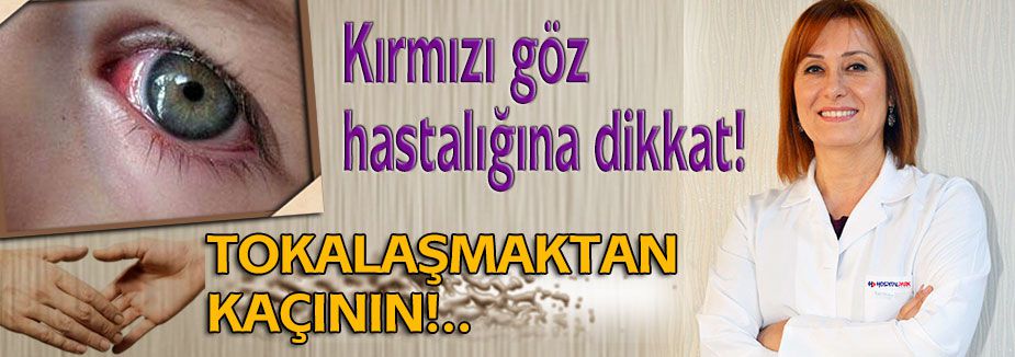 Kırmızı göze dikkat