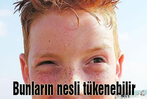 Kızıl saçlıların nesli tükenebilir
