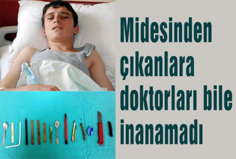 Midesinden çıkanlara doktorları bile inanamadı