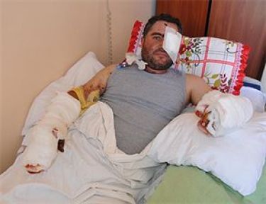 Yaptığı Bomba Elinde Patladı...