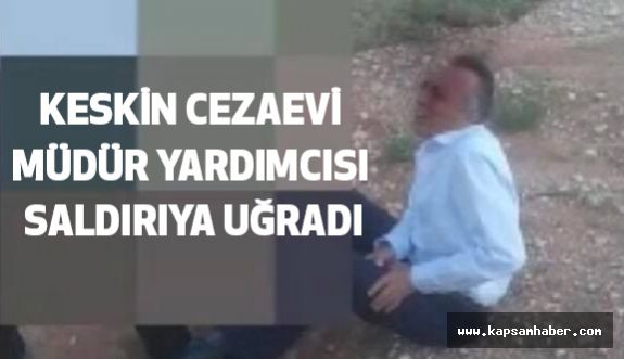 Keskin T tipi cezaevi 2.Müdürü Zafer Çolak Tabancayla Vuruldu