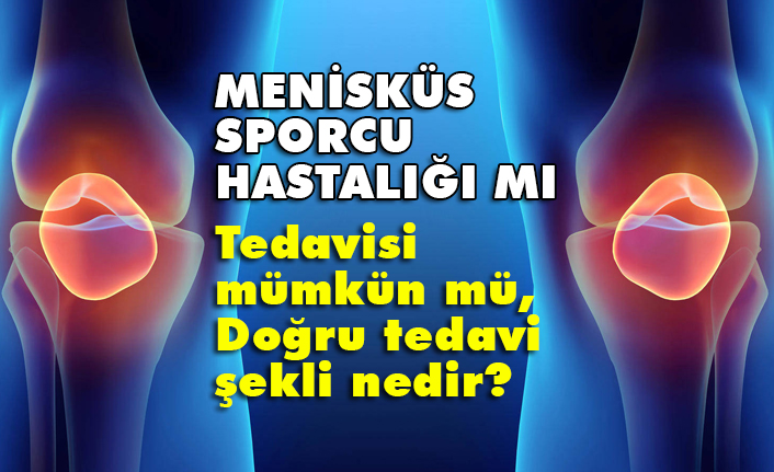 Menisküs yırtığıyla ilgili doğru bilinen yanlışlar (Menisküs sporcu hastalığı mı)