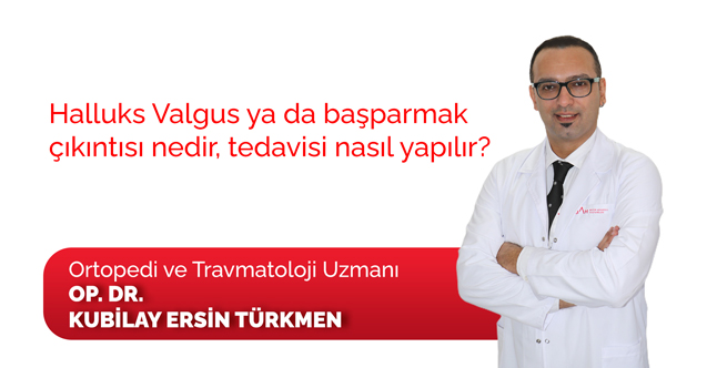 Halluks Valgus ya da başparmak çıkıntısı nedir, tedavisi nasıl yapılır?
