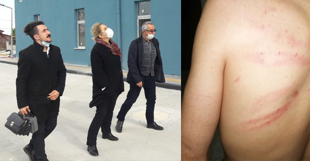 Samsun'da Gazeteci İbrahim Akkuş'a Yönelik Saldırıya Tepkiler Büyüyor