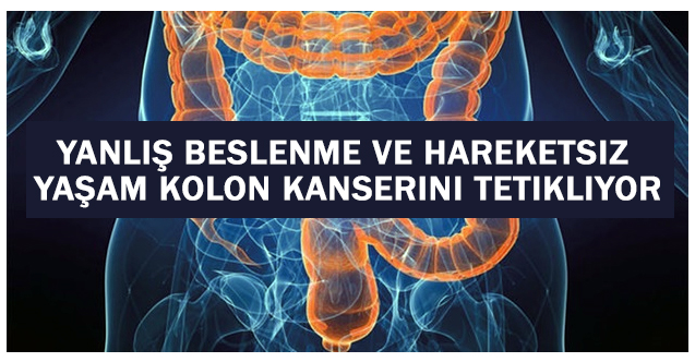 Yanlış beslenme ve hareketsiz yaşam kolon kanserini tetikliyor