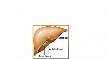 Safra Kesesi Ameliyatı
