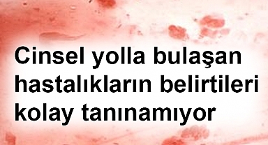Cinsel Yolla Bulaşan Hastalıklara Dikkat!