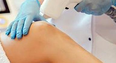 Lazer Epilasyon Zararlı Mı?