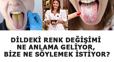 Dildeki Renk Değişimi Bize Ne Anlatıyor?