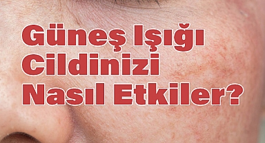 Güneş Işığı Cildinizi Nasıl Etkiler?