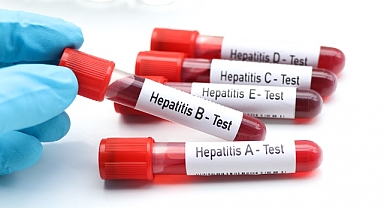 Tedavi Edilmeyen Hepatit Ölümcül Olabiliyor!