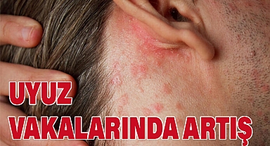 Uyuz Vakalarında Hızlı Artış