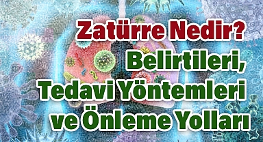 Zatürre Nedir? Belirtileri, Tedavi Yöntemleri ve Önleme Yolları