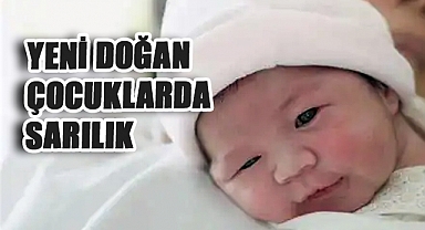 Yenidoğan Bebeklerde Sarılık