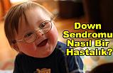 Down Sendromu Nasıl Bir Hastalık?