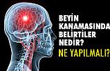 Beyin Kanaması Belirtileri Nedir?