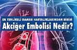 Akciğer Embolisi Nedir?
