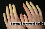 Raynaud Fenomeni Nedir?