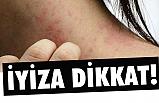 Uyuza Dikkat!