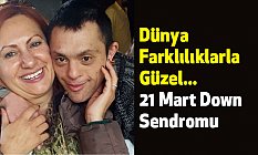 Down Sendromu Nedir?