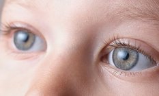Katarakt Nedir?