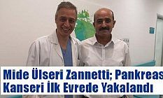 Mide Ülseri Zannetti; Pankreas Kanseri İlk Evrede Yakalandı